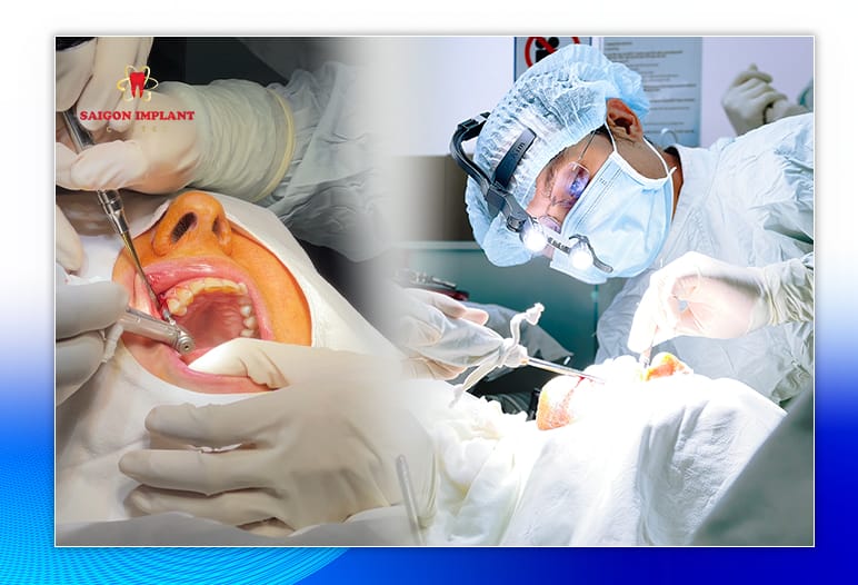 dental implant surgery in vietnam
